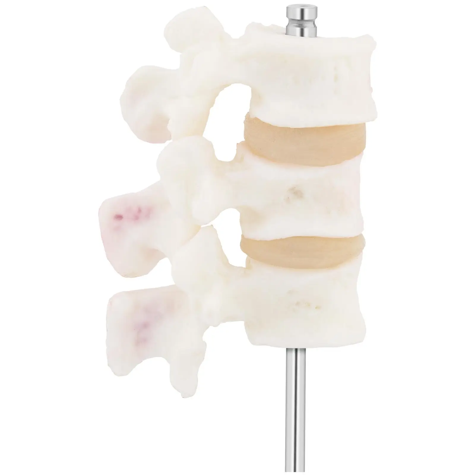 Lendenwirbel Modell - Osteoporose - koloriert